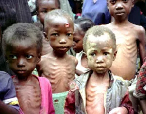 Malnutrition Crisis Escalates in Northern Nigeria: 51% Spike in Severe Cases, Warns MSF