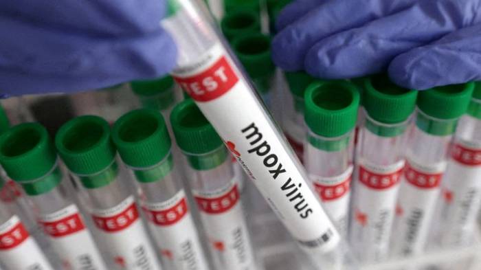 Nigeria and Eight Other Countries Receive 899,000 Mpox Vaccine Doses to Tackle Outbreak