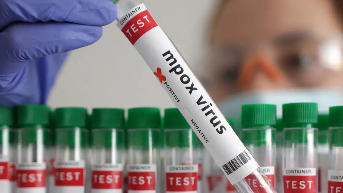 Africa CDC Endorses First Locally Made Mpox Test from Morocco